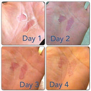 RipFix - Blisters & Rips Fix from RipFix for Genejack WOD
